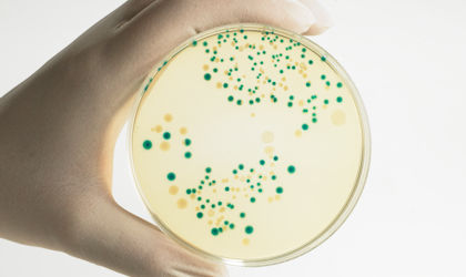 E. coli vs. Shiga toxin-producing E. coli - what’s the difference and what’s the problem?