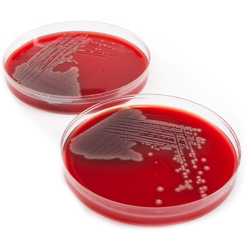 Two agar plates with E. coli culture growth