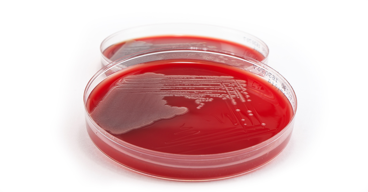 E.coli growing in agar plate