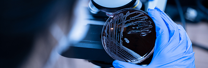 Microbiologist looking at agar plate with microscope in background